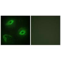 Immunofluorescence analysis of HeLa cells, using LATH antibody.