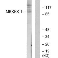 Western blot analysis of extracts from HepG2 cells, using MEKKK 1 antibody.