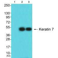 Western blot analysis of extracts from Hela cells (Lane 2) and HepG2 cells (Lane 3), using Keratin 7 antiobdy. The lane on the left is treated with synthesized peptide.