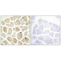 Immunohistochemistry analysis of paraffin-embedded human skeletal muscle tissue using MAPK3 antibody.