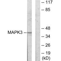 Western blot analysis of extracts from COLO205 cells, using MAPK3 antibody. Western blot analysis of extracts from COLO205 cells, using MAPK3 antibody.
