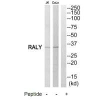 Western blot analysis of extracts from Jurkat cells and COLO205 cells, using RALY antibody. Western blot analysis of extracts from Jurkat cells and COLO205 cells, using RALY antibody.
