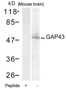 Western blot analysis of extracts from mouse brain tissue using GAP43(Ab-41) Antibody and the same antibody preincubated with blocking peptide. Western blot analysis of extracts from mouse brain tissue using GAP43(Ab-41) Antibody and the same antibody preincubated with blocking peptide.