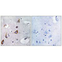 Immunohistochemistry analysis of paraffin-embedded human brain tissue, using CHSY1 antibody.