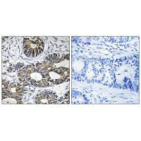 Immunohistochemistry analysis of paraffin-embedded human brain tissue using EIF1AY antibody. Immunohistochemistry analysis of paraffin-embedded human brain tissue using EIF1AY antibody.