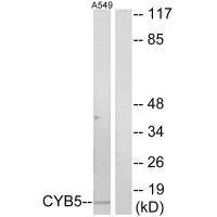 Western blot analysis of extracts from A549 cells, using CYB5 antibody. Western blot analysis of extracts from A549 cells, using CYB5 antibody.