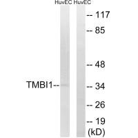 Western blot analysis of extracts from HuvEc cells, using TMBIM1 antibody.