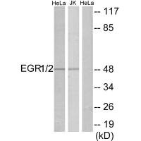 Western blot analysis of extracts from HeLa/Jurkat cells, using EGR1/2 antibody. Western blot analysis of extracts from HeLa/Jurkat cells, using EGR1/2 antibody.