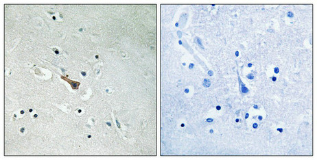 Immunohistochemical analysis of paraffin-embedded human brain tissue using APLP2 (Phospho-Tyr755) antibody (left)or the same antibody preincubated with blocking peptide (right). Immunohistochemical analysis of paraffin-embedded human brain tissue using APLP2 (Phospho-Tyr755) antibody (left)or the same antibody preincubated with blocking peptide (right).