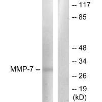 Western blot analysis of extracts from COS7 cells, using MMP-7 antibody.