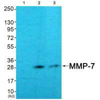 Western blot analysis of extracts from COS7 cells (Lane 2) and HuvEc cells (Lane 3), using MMP-7 antiobdy. The lane on the left is treated with systhesized peptide.