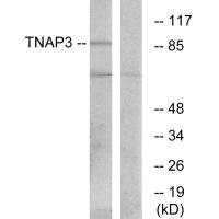 Western blot analysis of extracts from RAW264.7 cells, using TNAP3 antibody. Western blot analysis of extracts from RAW264.7 cells, using TNAP3 antibody.