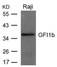 Western blot analysis of extracts from Raji cells using GFI1b Antibody. Western blot analysis of extracts from Raji cells using GFI1b Antibody.