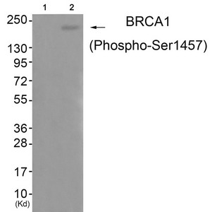 Western blot analysis of extracts from 293 cells (Lane 2), using BRCA1 (Phospho-Ser1457) Antibody. The lane on the left is treated with antigen-specific peptide. Western blot analysis of extracts from 293 cells (Lane 2), using BRCA1 (Phospho-Ser1457) Antibody. The lane on the left is treated with antigen-specific peptide.