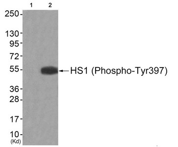Western blot analysis of extracts from JK cells (Lane 2), using HS1 (Phospho-Tyr397) Antibody.The lane on the left is treated with antigen-specific peptide. Western blot analysis of extracts from JK cells (Lane 2), using HS1 (Phospho-Tyr397) Antibody.The lane on the left is treated with antigen-specific peptide.