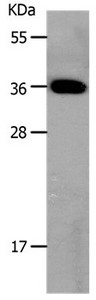 Gel: 10%SDS-PAGE Lysates (from left to right): Mouse large intestine tissue Amount of lysate: 30ug per lane Primary antibody: 1/800 dilution Secondary antibody dilution: 1/8000 Exposure time: 20 seconds Gel: 10%SDS-PAGE Lysates (from left to right): Mouse large intestine tissue Amount of lysate: 30ug per lane Primary antibody: 1/800 dilution Secondary antibody dilution: 1/8000 Exposure time: 20 seconds
