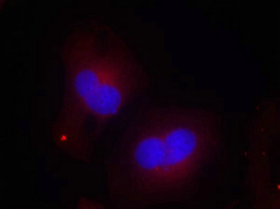 Immunofluorescence staining of methanol-fixed Hela cells using FAK(Phospho-Tyr925) Antibody.