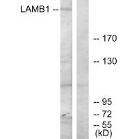 Western blot analysis of extracts from HepG2 cells, using LAMB1 antibody. Western blot analysis of extracts from HepG2 cells, using LAMB1 antibody.