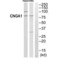 Western blot analysis of extracts from HepG2 cells and K562 cells, using CNGA1 antibody. Western blot analysis of extracts from HepG2 cells and K562 cells, using CNGA1 antibody.