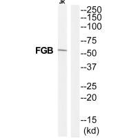 Western blot analysis of extracts from Jurkat cells, using FIBB antibody. Western blot analysis of extracts from Jurkat cells, using FIBB antibody.