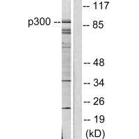 Western blot analysis of extracts from COLO205 cells, using P300/CBP antibody. Western blot analysis of extracts from COLO205 cells, using P300/CBP antibody.