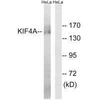 Western blot analysis of extracts from HeLa cells, using KIF4A antibody. Western blot analysis of extracts from HeLa cells, using KIF4A antibody.
