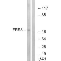 Western blot analysis of extracts from COS-7 cells, using FRS3 antibody.