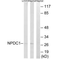 Western blot analysis of extracts from LOVO cells and HepG2 cells, using NPDC1 antibody. Western blot analysis of extracts from LOVO cells and HepG2 cells, using NPDC1 antibody.