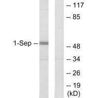 Western blot analysis of extracts from Jurkat cells, using SEPT1 antibody. Western blot analysis of extracts from Jurkat cells, using SEPT1 antibody.