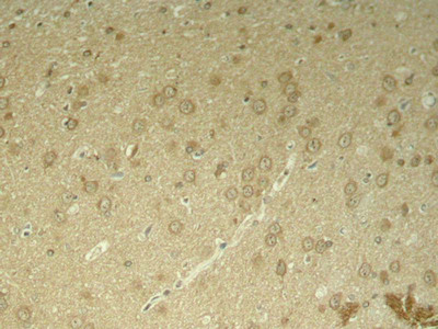 Immunohistochemical analysis of paraffin-embedded rat hippocampal region tissue from a model with Alzheimer