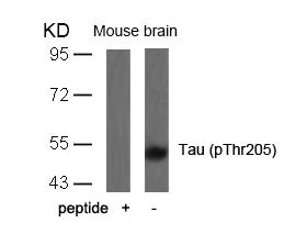 Western blot analysis of extracts from mouse brain tissue using Tau(Phospho-Thr205) Antibody and the same antibody preincubated with blocking peptide. Western blot analysis of extracts from mouse brain tissue using Tau(Phospho-Thr205) Antibody and the same antibody preincubated with blocking peptide.