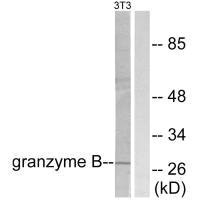 Western blot analysis of extracts from NIH/3T3 cells, using Granzyme B antibody. Western blot analysis of extracts from NIH/3T3 cells, using Granzyme B antibody.