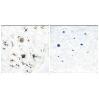 Immunohistochemical analysis of paraffin-embedded human brain tissue using Ephrin-B3 antibody.