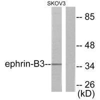 Western blot analysis of extracts from SKOV3 cells, using Ephrin-B3 antibody. Western blot analysis of extracts from SKOV3 cells, using Ephrin-B3 antibody.