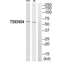 Western blot analysis of extracts from 3T3 cells and Jurkat cells, using TSEN54 antibody. Western blot analysis of extracts from 3T3 cells and Jurkat cells, using TSEN54 antibody.