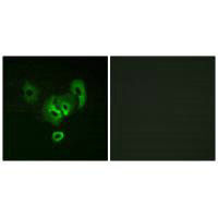 Immunofluorescence analysis of A549 cells, using STEA2 antibody.