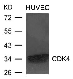 Western blot analysis of extracts from HUVEC cells using CDK4 Antibody. Western blot analysis of extracts from HUVEC cells using CDK4 Antibody.
