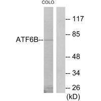 Western blot analysis of extracts from COLO205 cells, using ATF6B antibody. Western blot analysis of extracts from COLO205 cells, using ATF6B antibody.