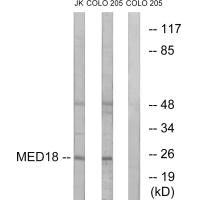 Western blot analysis of extracts from Jurkat cells and COLO cells, using MED18 antibody. Western blot analysis of extracts from Jurkat cells and COLO cells, using MED18 antibody.