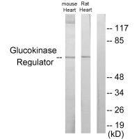 Western blot analysis of extracts from mouse heart cells and rat heart cells, using Glucokinase Regulator antibody. Western blot analysis of extracts from mouse heart cells and rat heart cells, using Glucokinase Regulator antibody.