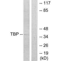 Western blot analysis of extracts from 293 cells, using TBP antibody. Western blot analysis of extracts from 293 cells, using TBP antibody.