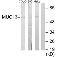 Western blot analysis of extracts from COLO cells, 293 cells and HeLa cells, using MUC13 antibody. Western blot analysis of extracts from COLO cells, 293 cells and HeLa cells, using MUC13 antibody.