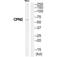 Western blot analysis of extracts from HeLa cells, using CPN2 antibody. Western blot analysis of extracts from HeLa cells, using CPN2 antibody.