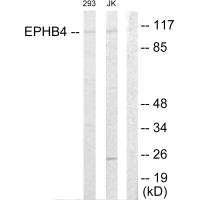 Western blot analysis of extracts from 293 cells and Jurkat cells, using EPHB4 antibody. Western blot analysis of extracts from 293 cells and Jurkat cells, using EPHB4 antibody.