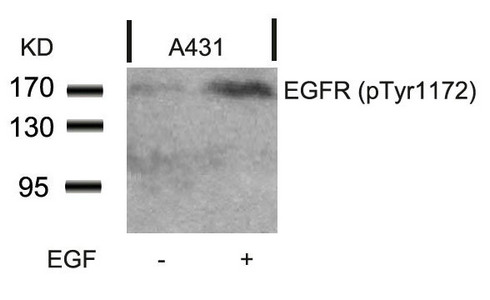 Western blot analysis of extracts from A431 cells untreated or treated with EGF using EGFR(Phospho-Tyr1172) Antibody. Western blot analysis of extracts from A431 cells untreated or treated with EGF using EGFR(Phospho-Tyr1172) Antibody.