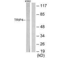 Western blot analysis of extracts from K562 cells, using TRIP4 antibody. Western blot analysis of extracts from K562 cells, using TRIP4 antibody.