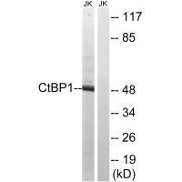 Western blot analysis of extracts from Jurkat cells, using CtBP1 (Ab-422) antibody. Western blot analysis of extracts from Jurkat cells, using CtBP1 (Ab-422) antibody.