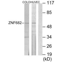 Western blot analysis of extracts from COLO205 cells and HUVEC cells, using ZNF682 antibody. Western blot analysis of extracts from COLO205 cells and HUVEC cells, using ZNF682 antibody.