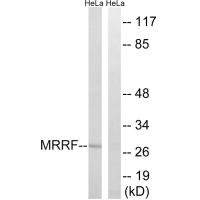 Western blot analysis of extracts from HeLa cells, using MRRF antibody. Western blot analysis of extracts from HeLa cells, using MRRF antibody.