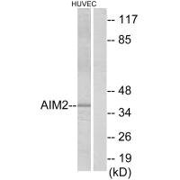 Western blot analysis of extracts from HUVEC cells, using AIM2 antibody. Western blot analysis of extracts from HUVEC cells, using AIM2 antibody.